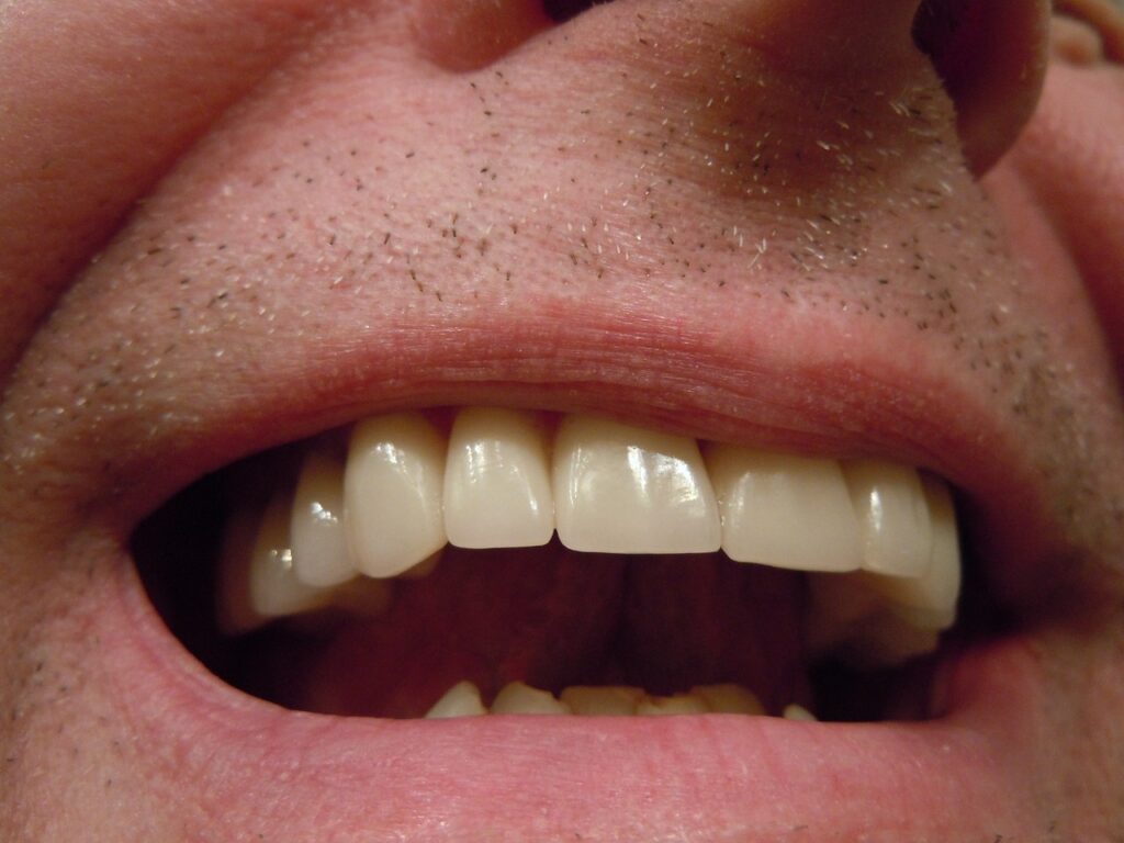 teeth dental tooth mouth lips 414489